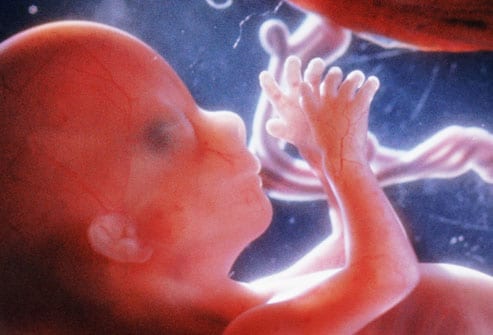 embryos at 5 weeks. 20 week fetus