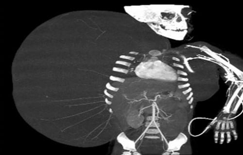 X-ray showing Jesus Rodriguez's tumor before surgery Picture: AP