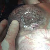 post thumbnail