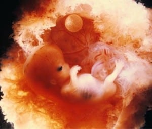 10 week fetus in the womb