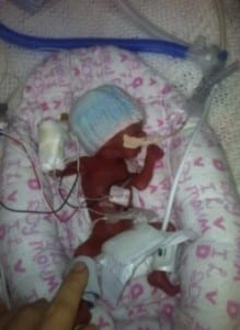 11 ounce preemie Alexis Clarke