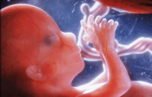 15 week fetus