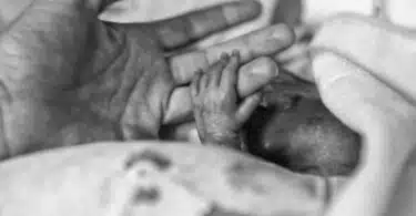 premature baby