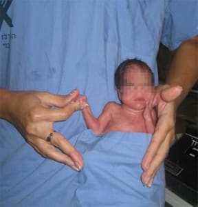 Nurse photographed with premature baby in her pocket 2