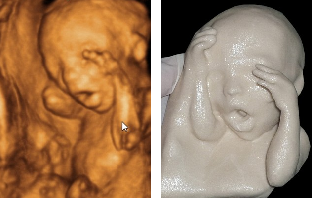 3-D Fetus Model