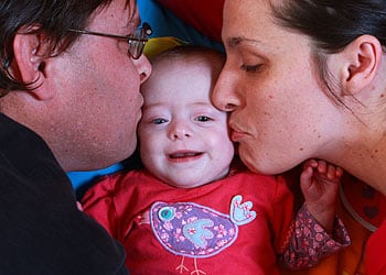Amazing Micro-preemie Defies Odds By Surviving Without Pancreas