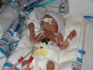 Preemie Profile: 26 Week Twins Peyton and Marc