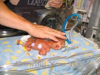 Prematurity Month: NICU Nurse Insight