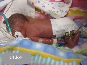 Preemie Profile: 24 Week Twins Bryce and Chloe