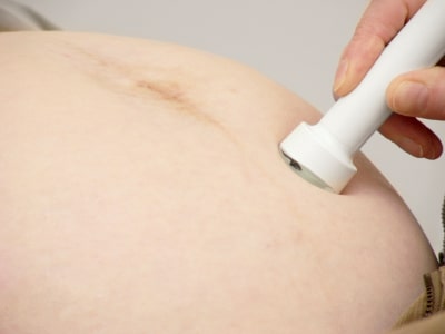 Doctors Warn Against Using Fetal Heart Rate Monitors at Home