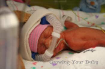 Preemie Profile: 27 Weekers Matthew & Andrew