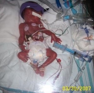 Preemie Profile: 26 Week Twins Brian & Rylan