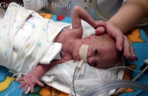 Preemie Profile: 25 Weeker Tyler