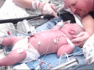 Minnesota Mom Gives Birth to 15 Pound Baby