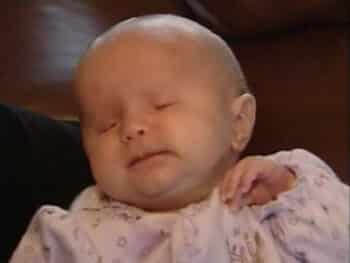 Baby in Florida Born Without Eyes