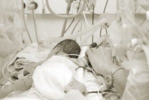 Study: Micro-Preemies Face Higher Risk of Autism