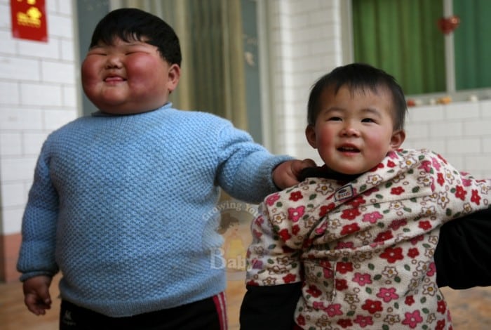 Chinese Toddler Weighs In At 90lbs