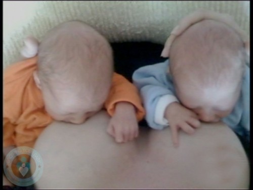 Julie Bowen Breastfeeding her twins