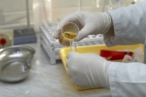 Urine testing