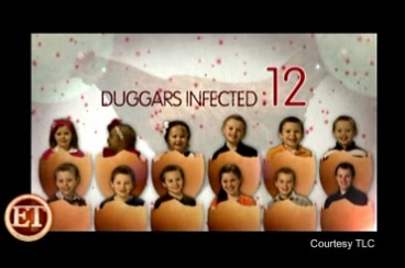 Duggars get chickenpox