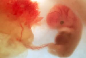 8 week fetus