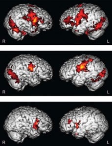 fmri autism