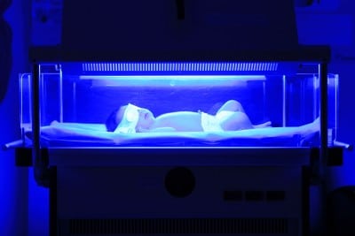 newborn having a treatment for jaundice under ultraviolet light in incubator