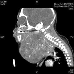 X-Ray of Jade Fleming