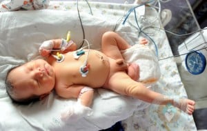 Baby in China Born With 3 Legs