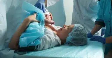 c-section