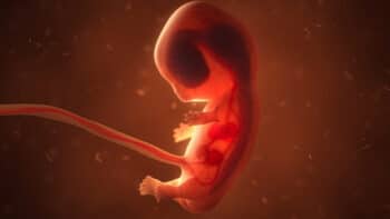 8 week fetus