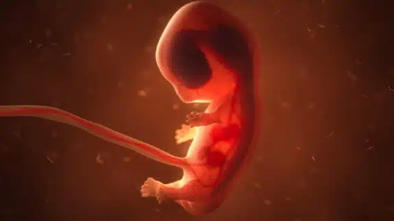 8 week fetus