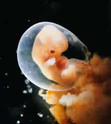 8week fetus