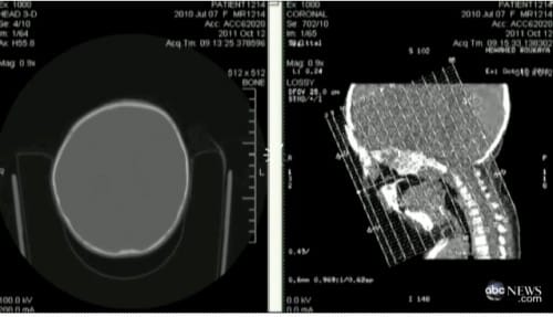 rokaya mohamed xrays