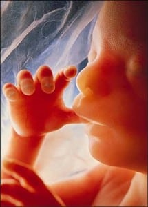 18 week fetus