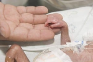 premature baby in incubator