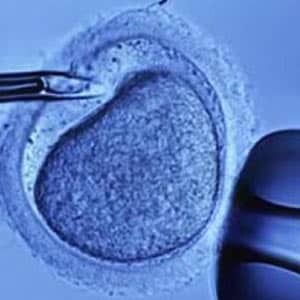 IVF