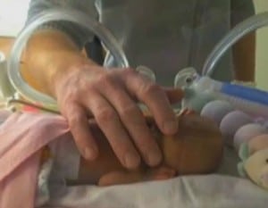 micro-preemie Kenna Moore weighing 1 pound