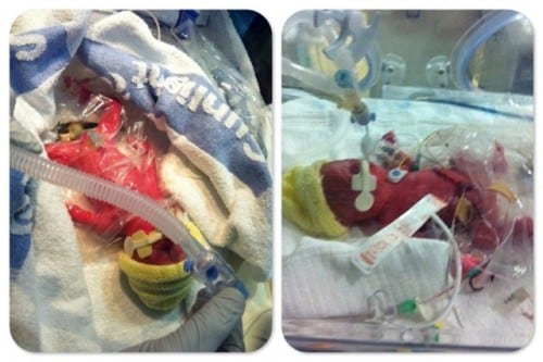 micropreemie twins