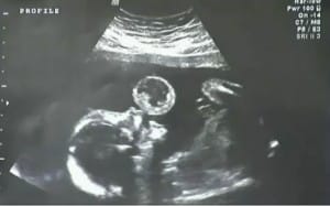 Leyna Gonzalez in utero