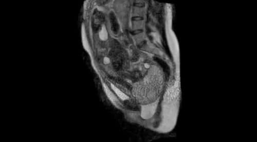 fmri childbirth