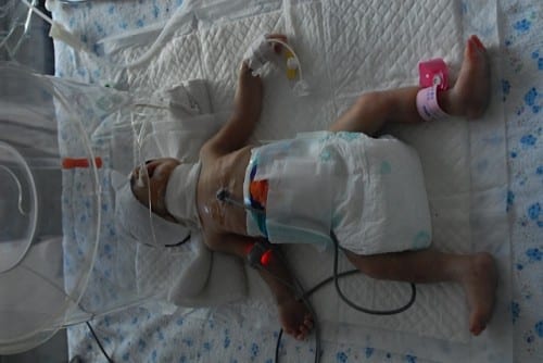 abandoned preemie in china