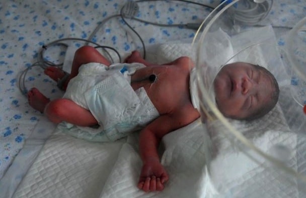premature baby abandoned china