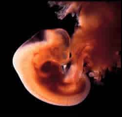 6 week old fetus