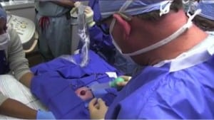 Doctors operating ectopia cordis