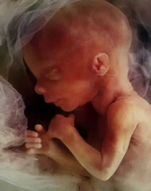 image of a human fetus