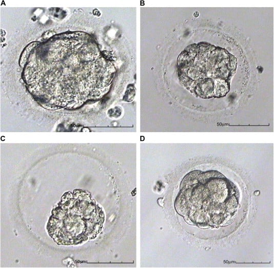 Early Embryo Viability Assessment