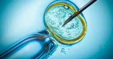 IVF procedure