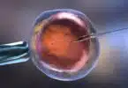 Artificial insemination or in vitro fertilization