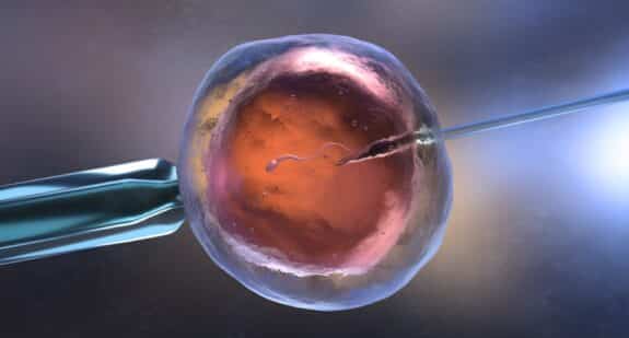  Artificial insemination or in vitro fertilization 
